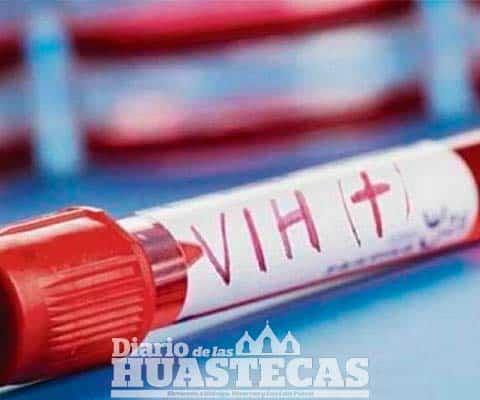 Reportó 92 personas con el virus del VIH

