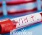 Reportó 92 personas con el virus del VIH